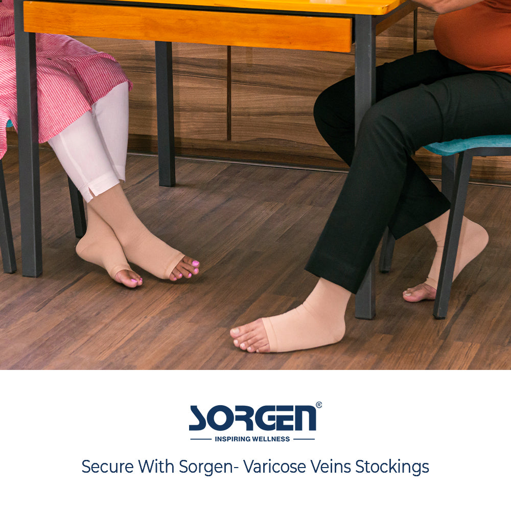 5 Things You Should Be Doing After a Varicose Vein Treatment