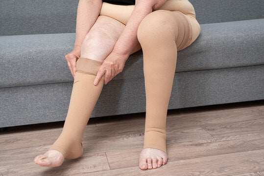 Lymphedema Management with Sorgen Medical Compression Stockings