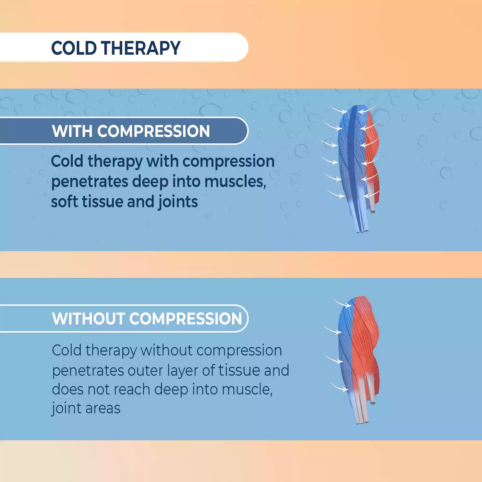 calf compression bandage
